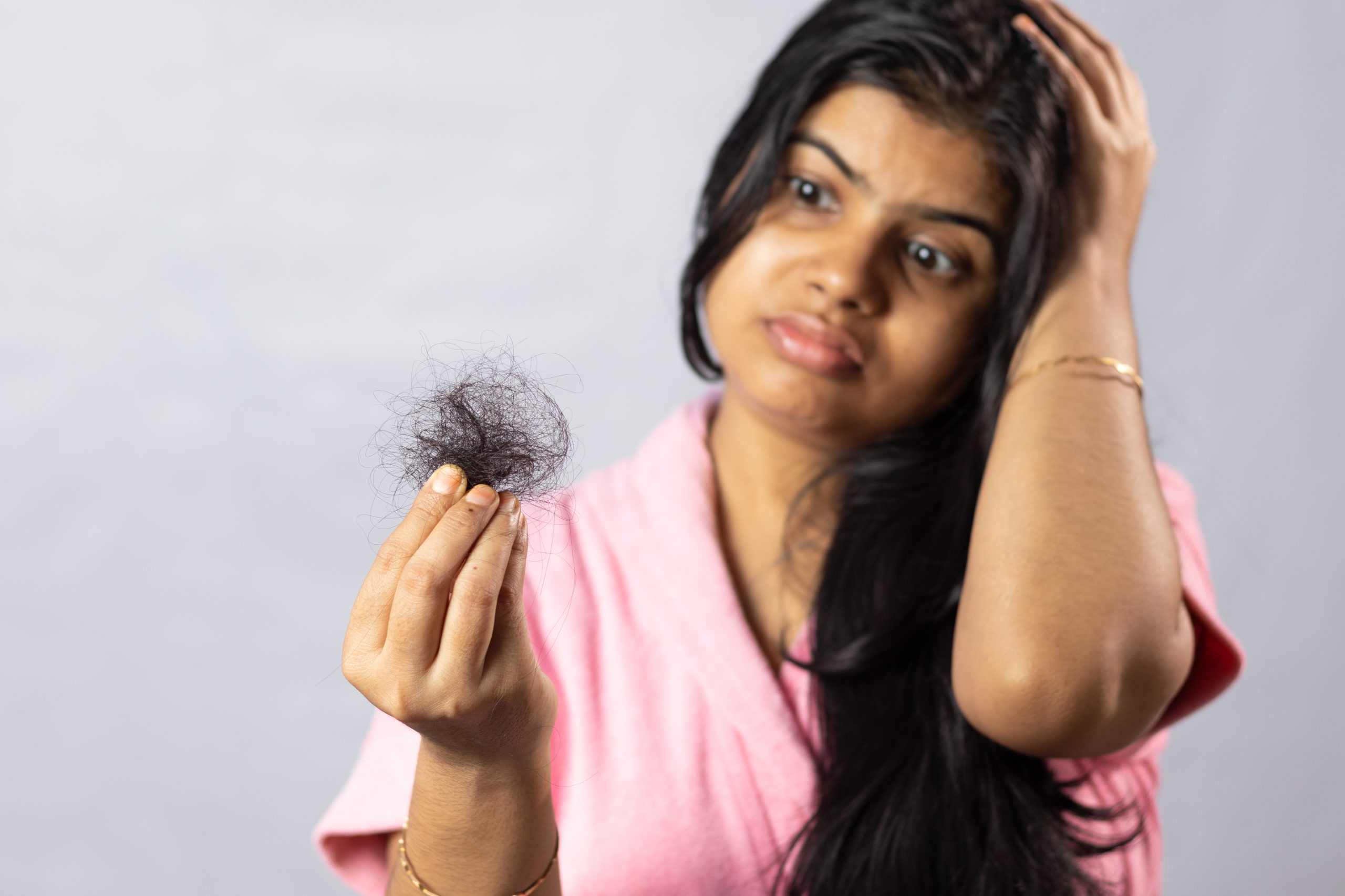 Woman holding hair fall showing PCOS-related hair thinning